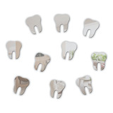10 Unidades Espelho Decorativo Acrílico Dente Odontologia Cor Da Moldura Prata