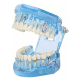 Dente.