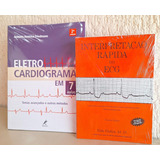 Interpretação Rápida Do Ecg + Eletrocardiograma