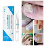 Kit 4 Canetas Com Solução Anti Micose E Anti Fungos Unhas Cor Água