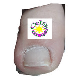 Pçs