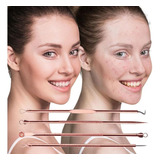 Kit Extrator De Cravos Profissional Removedor Acne Espinha