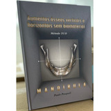 Livro: Aumentos Ósseos Verticais E Horizontais Sem Biomaterial Método Tco Mandíbula