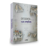 Livro: Ortodontia Em Casos Complexos - Biomecânica Racional - Mauricio Tatsuei Sakima, Acácio Fuzily E Angelo Vicentini Loiola