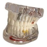 Macro Modelo Adulto Completo Com Próteses E Implantes + Nf
