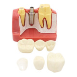 Manequim Dente Boca Modelo Odontológico