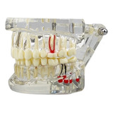 Dental