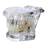 Manequim Modelo Dentário Ortodontia Dente Boca