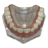 Manequim Modelo Odontológico Prótese Total Sup.