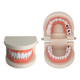 Dentes