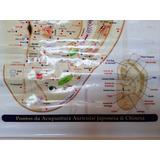 Mapa De Auricular Acupuntura 90cmx60cm Lona