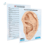 Acupuntura