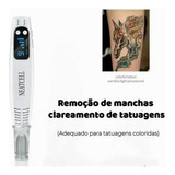 Máquina Preta Do Laser Da Remoção T Da Tatuagem Do Ponto Da