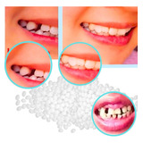 Massa Para Restaurar Dente Caseiro Protese Tampa Buraco