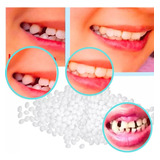 Massa Restauração Dente Quebrado Buraco Dental Provisórios
