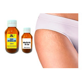 Melasma/clareador (ácido Retinoíco 40%) 20ml Kit 