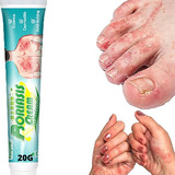 Melhor Pomada Para Dermatite Atópica