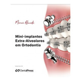 Mini Implantes Extra Alveolares Em Ortodontia,