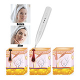 Mini Laser Pen Mole Remoção De Sardas Removedor De Tatuagem
