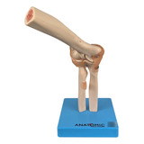 Modelo Anatômico Articulação Cotovelo Ligamentos Anatomic
