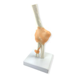 Modelo Anatômico De Articulação Do Cotovelo