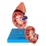 Modelo Anatômico Rim Humano 2 Partes Anatomic