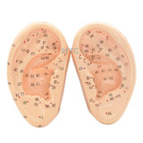 Acupuntura