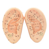 Auriculoterapia