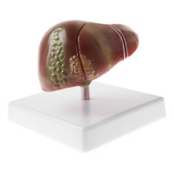 Modelo Patológico Do Fígado Humano Para