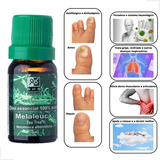 Oleo Essencial Melaleuca Tea Tree Puro Natural Australiano