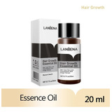Oleo Para Queda De Cabelo Natural Calvice Masculina Hair