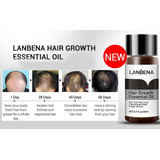 Oleo Para Queda De Cabelo Natural Calvice Tem Cura Hair