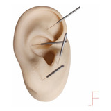 Auriculoterapia
