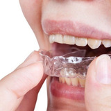 Placa Moldável Para Bruxismo Ranger Dentes 1 Par + 1 Caixa