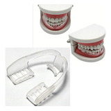 Protetor Placa Bucal Anti Bruxismo Silicone Macio + Estojo