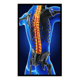 Quadro Decorativo Medicina Anatomia Coluna Vertebral