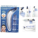 Dermasuction