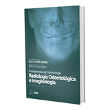 Série Fundamentos De Odonto Radiologia Odonto
