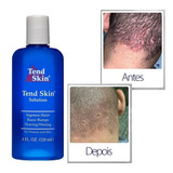 Solução Tend Skin Liquido Pelos Encravados Foliculite 118ml