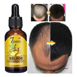 Tratamento De Calvície Cura Cabelo Careca Nasce Freeshipping