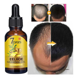 Tratamento De Calvície Cura Cabelo Careca Nasce Freeshipping
