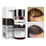 Vitamina Para Queda De Cabelo Natural Calvicie Hair