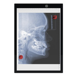 A4 Negatoscopio 1 Corpo