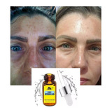 20ml