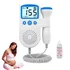 Aparelho De Ultrassom Ouvir Batimentos Bebe Monitor Dopller Cor Sortidos