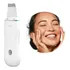 Aparelho Para Limpeza Facial Maquina Portátil Pá Peeling