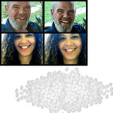 Bolinhas Moldáveis Para Reparação Dos Dentes