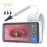 Câmera De Ouvido Scopearound Otoscope 1080p Hd Com Tela De 4