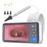 Câmera De Ouvido Scopearound Otoscope 1080p Hd Com Tela De 4