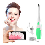 Camera Intra Oral Odontologica